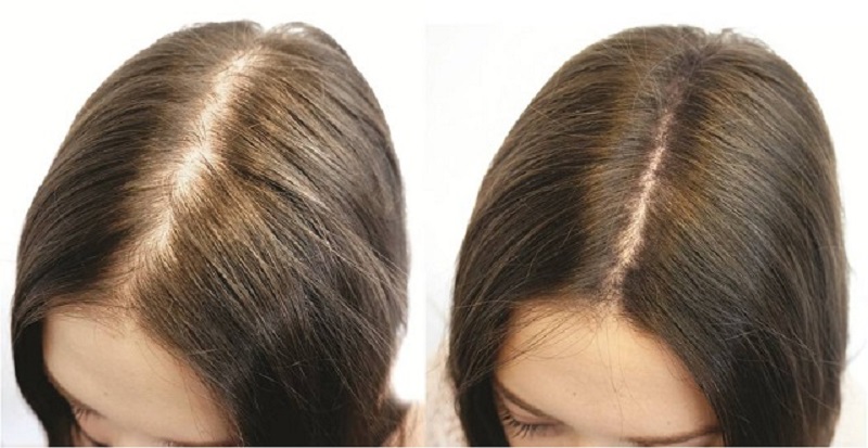 1-45